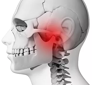 MANDÍBULA ESTALANDO (ESTRALANDO) - Disfunção da articulação  temporomandibular (ATM/DTM) 